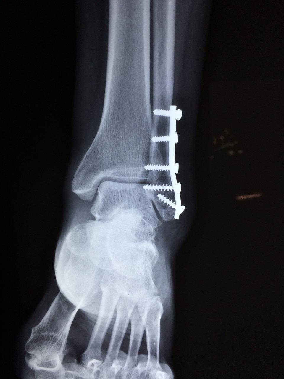 Orthopedie in Delft